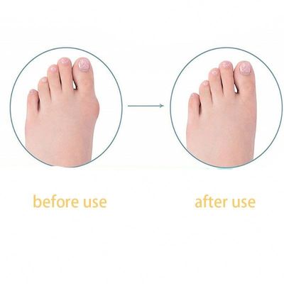 TPR Adult Big Foot Straightener Bunion Correction Day/Night Children Thumb Toe Straightener For Shoes